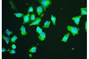 IF analysis of HSPA2 using anti-HSPA2 antibody (ABIN5692870).
