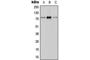 Western blot analysis of CNT1 expression in HEK293T (A), mouse brain (B), H9C2 (C) whole cell lysates. (SLC28A1 抗体  (Center))