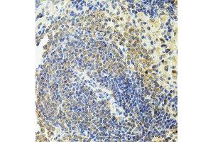 Immunohistochemistry of paraffin-embedded rat spleen using RALBP1 antibody. (RALBP1 抗体  (AA 396-655))