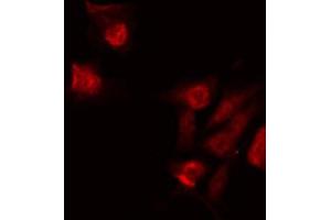 ABIN6268928 staining 293 by IF/ICC. (Caspase 6 抗体  (Cleaved-Asp179))