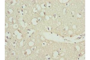 Immunohistochemistry of paraffin-embedded human brain tissue using ABIN7176197 at dilution of 1:100 (ZNF264 抗体  (AA 1-220))