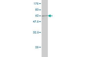 Western Blot detection against Immunogen (57. (PIH1D1 抗体  (AA 1-290))