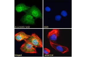 ABIN184965 Immunofluorescence analysis of paraformaldehyde fixed U2OS cells, permeabilized with 0. (TRIM21 抗体  (C-Term))