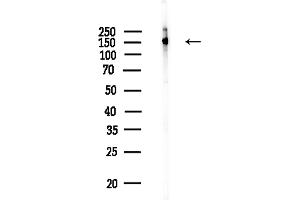 anti-Splicing Factor 3b, Subunit 1, 155kDa (SF3B1) (pThr313) antibody