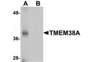 Western blot analysis of TMEM38A in rat skeletal muscle tissue lysate with TMEM38A antibody at 1 μg/mL in (A) the absence and (B) the presence of blocking peptide. (TMEM38A 抗体  (C-Term))