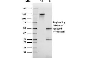 SDS-PAGE Analysis Purified FABP2 Mouse Monoclonal Antibody (CPTC-FABP2-3). (FABP2 抗体)