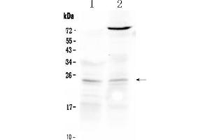 Western blot analysis of TIMP3 using anti- TIMP3 antibody . (TIMP3 抗体  (Middle Region))