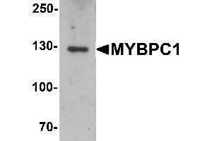 Western blot analysis of MYBPC1 in rat skeletal muscle tissue lysate with MYBPC1 antibody at 1 µg/mL. (MYBPC1 抗体  (N-Term))