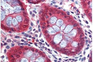 Human Colon: Formalin-Fixed, Paraffin-Embedded (FFPE) (Caspase 7 抗体  (C-Term))