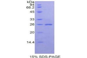 SDS-PAGE analysis of Mouse CLCF1 Protein. (CLCF1 蛋白)