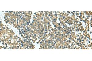 Immunohistochemistry of paraffin-embedded Human tonsil tissue using KRT36 Polyclonal Antibody at dilution of 1:50(x200) (Keratin 36 抗体)