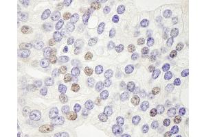 Immunohistochemistry (IHC) image for anti-DEK Oncogene (DEK) (AA 225-275) antibody (ABIN7448525) (DEK 抗体  (AA 225-275))