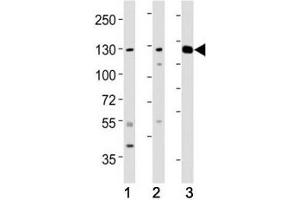 Western blot testing of ROR1 antibody at 1:2000 dilution.