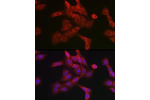 Immunofluorescence analysis of PC-12 cells using Cathepsin B Rabbit pAb (ABIN3021175, ABIN3021176, ABIN3021177 and ABIN6214050) at dilution of 1:100 (40x lens). (Cathepsin B 抗体  (AA 1-339))