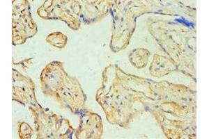 Immunohistochemistry of paraffin-embedded human placenta tissue using ABIN7170774 at dilution of 1:100 (SOAT1 抗体  (AA 1-130))