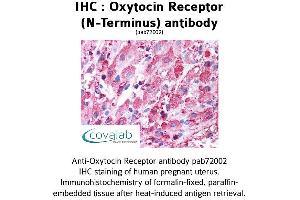Image no. 1 for anti-Oxytocin Receptor (OXTR) (Extracellular Domain), (N-Term) antibody (ABIN1737740) (Oxytocin Receptor 抗体  (Extracellular Domain, N-Term))