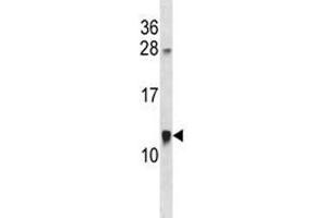 ACBD7 antibody western blot analysis in MDA-MB453 lysate. (ACBD7 抗体  (AA 60-88))