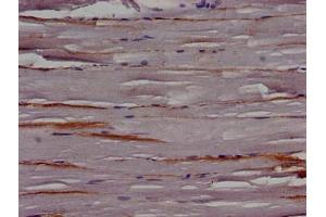 Immunohistochemistry of paraffin-embedded human skeletal muscle tissue using ABIN7147218 at dilution of 1:100