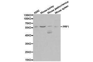 Western Blotting (WB) image for anti-Perforin 1 (Pore Forming Protein) (PRF1) antibody (ABIN1874263) (Perforin 1 抗体)