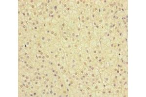Immunohistochemistry of paraffin-embedded human adrenal gland tissue using ABIN7159655 at dilution of 1:100 (MMACHC 抗体  (AA 63-282))