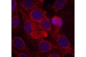 Immunofluorescence staining of methanol-fixed MCF-7 cells using Phospho-KDR-Y1175 antibody (ABIN2988109). (VEGFR2/CD309 抗体  (pTyr1175))