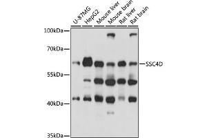 Western blot analysis of extracts of various cell lines, using SSC4D antibody (ABIN7270158) at 1000 dilution. (SRCRB4D 抗体  (AA 446-575))
