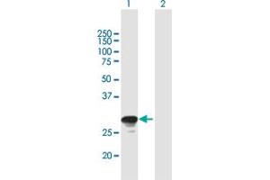 Western Blot analysis of RAB26 expression in transfected 293T cell line by RAB26 MaxPab polyclonal antibody. (RAB26 抗体  (AA 1-256))
