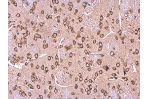 IHC-P Image LYRIC antibody [N2C3] detects LYRIC protein at cytosol on mouse fore brain by immunohistochemical analysis.