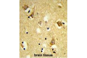 Immunohistochemistry (Paraffin-embedded Sections) (IHC (p)) image for anti-Apolipoprotein B mRNA Editing Enzyme, Catalytic Polypeptide-Like 3F (APOBEC3F) (AA 28-57), (N-Term) antibody (ABIN950460)