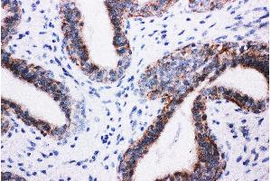 Immunohistochemistry (IHC) image for anti-Phosphoinositide 3 Kinase, p85 beta (PI3K p85b) (AA 447-461), (Middle Region) antibody (ABIN3044260)