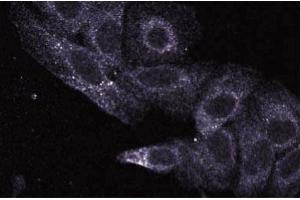 Immunofluorescence staining of HeLa cells (Human cervical epitheloid carcinoma, ATCC CCL-2. (UBE2L3 抗体  (AA 15-133))