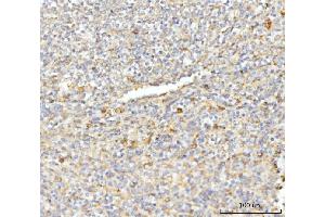 IHC analysis of EIF3E using anti-EIF3E antibody (ABIN7600190). (EIF3E 抗体  (AA 160-249))