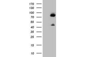 Image no. 1 for anti-Coagulation Factor XIII, A1 Polypeptide (F13A1) antibody (ABIN1498154) (F13A1 抗体)