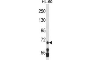 Western Blotting (WB) image for anti-Myeloid/lymphoid Or Mixed-Lineage Leukemia 5 (Trithorax Homolog) (MLL5) antibody (ABIN2995217) (MLL5/KMT2E 抗体)