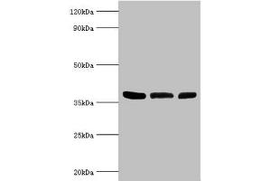 Western blot All lanes: ARG2 antibody at 5 μg/mL Lane 1: Mouse liver tissue Lane 2: 293T whole cell lysate Lane 3: Mouse kidney tissue Secondary Goat polyclonal to rabbit IgG at 1/10000 dilution Predicted band size: 39 kDa Observed band size: 39 kDa (ARG2 抗体  (AA 1-354))