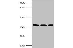 Western blot All lanes: ARG2 antibody at 5 μg/mL Lane 1: Mouse liver tissue Lane 2: 293T whole cell lysate Lane 3: Mouse kidney tissue Secondary Goat polyclonal to rabbit IgG at 1/10000 dilution Predicted band size: 39 kDa Observed band size: 39 kDa (ARG2 抗体  (AA 1-354))