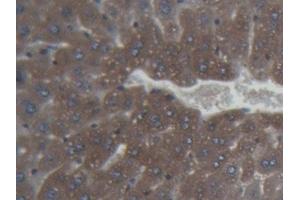 Detection of FTH in Mouse Liver Tissue using Monoclonal Antibody to Ferritin, Heavy Polypeptide (FTH) (FTH1 抗体  (AA 1-182))