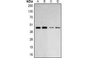 Western blot analysis of ARP2 expression in HepG2 (A), Hela (B), mouse lung (C), mouse brain (D) whole cell lysates. (ARPC1B 抗体)