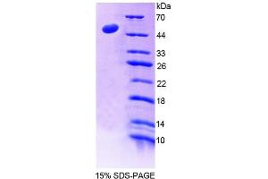 SDS-PAGE analysis of Human LAD1 Protein. (Ladinin 1 Protein (LAD1))