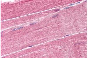 Human Skeletal Muscle (formalin-fixed, paraffin-embedded) stained with TRIM63 antibody ABIN293523 at 1. (TRIM63 抗体  (AA 2-14))