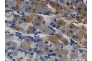 Detection of RNASE3 in Human Stomach Tissue using Monoclonal Antibody to Ribonuclease A3 (RNASE3) (RNASE3 抗体  (AA 30-154))