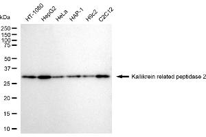 anti-Kallikrein 2 (KLK2) antibody