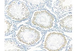 ABIN6257718 and ABIN6275927 at 1/100 staining Rat testis tissue by IHC-P.