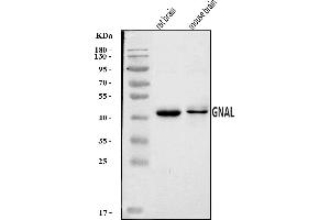 Western blot analysis of GNAL using anti-GNAL antibody (ABIN7599757).