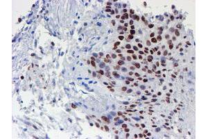 Image no. 8 for anti-WW Domain Containing Transcription Regulator 1 (WWTR1) antibody (ABIN1501763) (WWTR1 抗体)