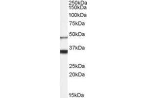 AP31067PU-N HCRTR1 antibody staining of Human Brain lysate at 0. (HCRTR1 抗体  (Internal Region))