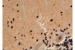 Immunohistochemistry (IHC) image for anti-S-Antigen, Retina and Pineal Gland (Arrestin) (SAG) (Internal Region) antibody (ABIN2465438) (SAG 抗体  (Internal Region))