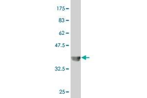Western Blotting (WB) image for anti-Solute Carrier Family 18 (Vesicular Monoamine Transporter), Member 2 (SLC18A2) (AA 53-151) antibody (ABIN520261)