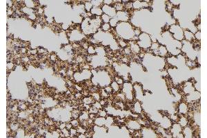 ABIN6258435 and ABIN6275055 at 1/100 staining Mouse lung tissue by IHC-P. (DHRS4 抗体  (C-Term))