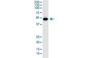 IKIP monoclonal antibody (M02), clone 2D5. (IKbIP 抗体  (AA 1-377))